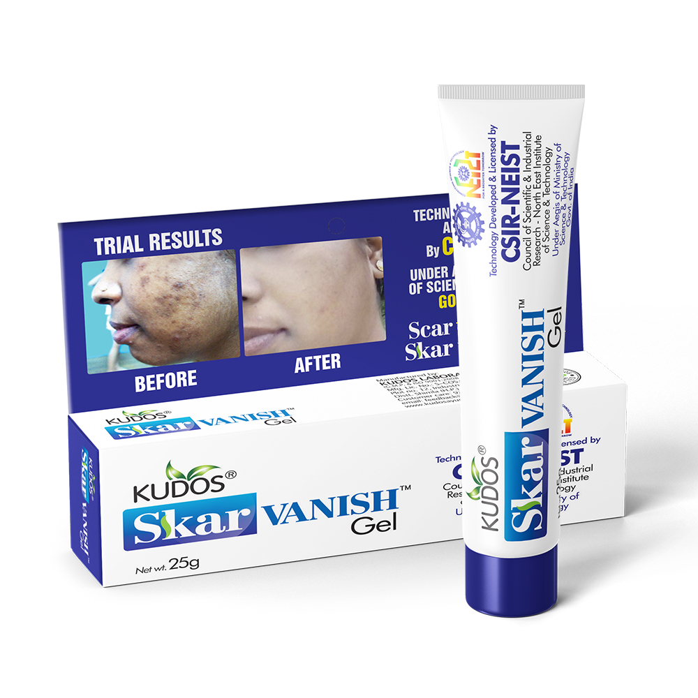 Skar Vanish Gel | Your Ultimate Solution for Scar Removal